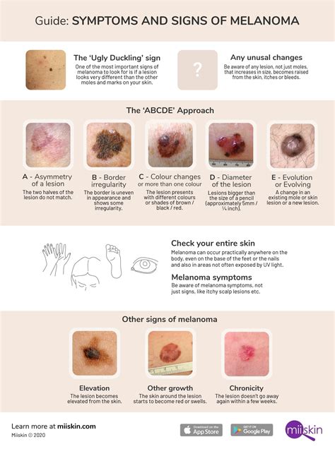 show me a picture of a mole|Melanoma Skin Disorder: Pictures, Causes And Symptoms